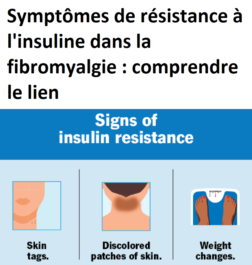 Symptômes de résistance à l'insuline dans la fibromyalgie comprendre — free download